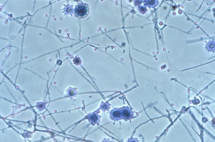 Photomicrograph of the mold phase of <i>Histoplasma
capsulatum</i> showing tuberculate macroconidia and microconidia.
